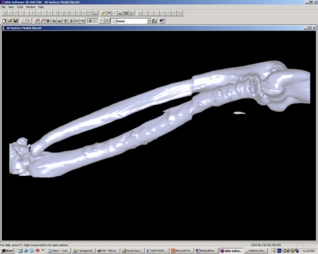 Wygląd kości ramiennej w programie 3D Doctor