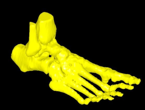 Model kości stopy w programie 3D Doctor